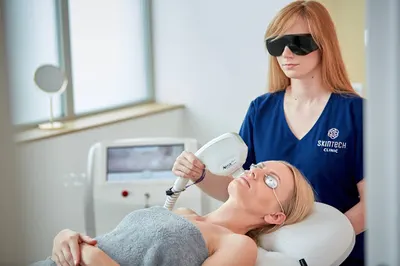SkinTech Clinic Depilacja Laserowa, Laser Alma, Endermologia LPG, Dermapen, Oczyszczanie Wodorowe